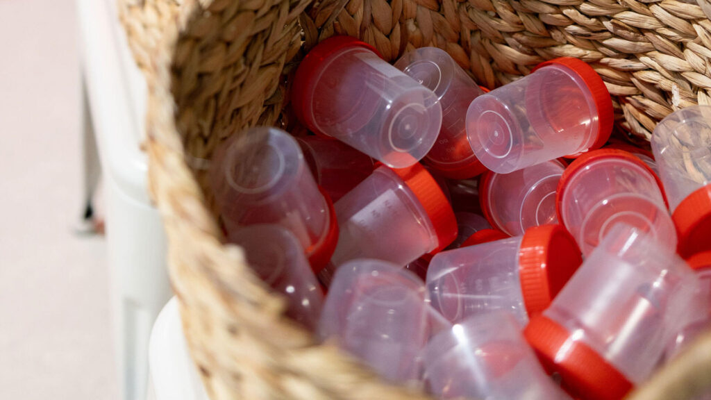 Urine onderzoek bij de huisarts